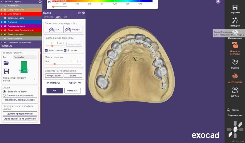 Exocad DentalCad Elefsina